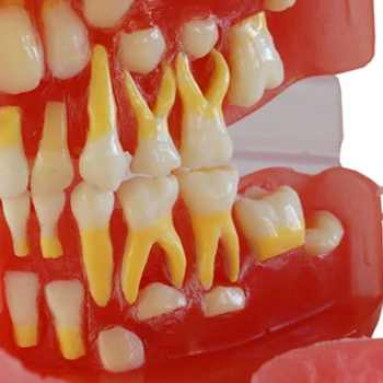 Модель зубов с 28 съемными зубьями Медицинский учебный инструмент Демонстрационная модель восстановления зубов для изучения